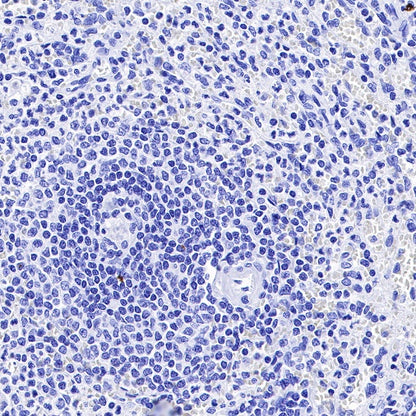S-RMab® CGA/HCG-α Recombinant Rabbit mAb (SDT-643-61)