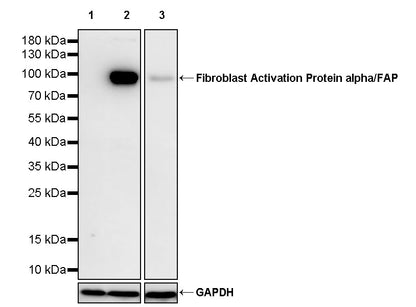 Fibroblast Activation Protein alpha/FAP Recombinant Rabbit mAb (S-3998-2)