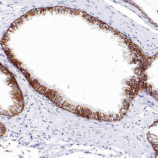 Mrp4 Recombinant Rabbit mAb (S-2305-17)