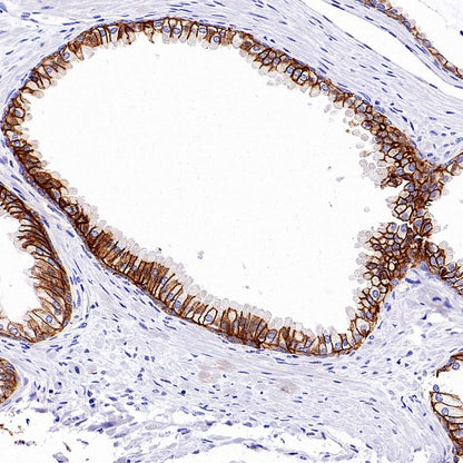 Mrp4 Recombinant Rabbit mAb (S-2305-17)