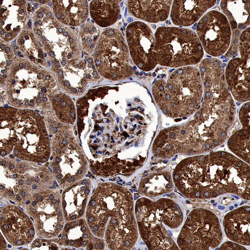 Catalase Rabbit Polyclonal Antibody