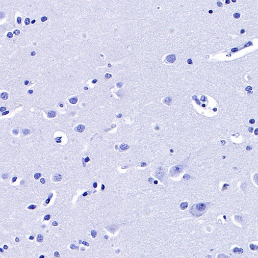 FSHB Recombinant Rabbit mAb (SDT-R287)