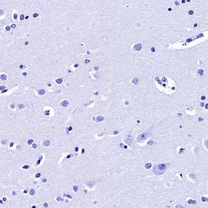 FSHB Recombinant Rabbit mAb (SDT-R287)