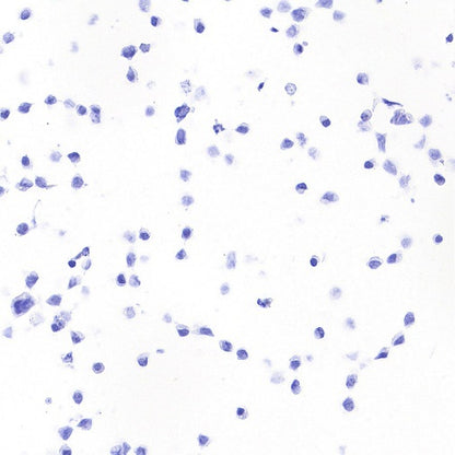 STEAP3 Recombinant Rabbit mAb (S-4466-26)