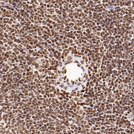 Histone H3 (acetyl K9) Recombinant Rabbit mAb (S-1704-76)