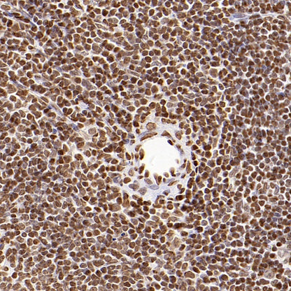 Histone H3 (acetyl K9) Recombinant Rabbit mAb (S-1704-76)