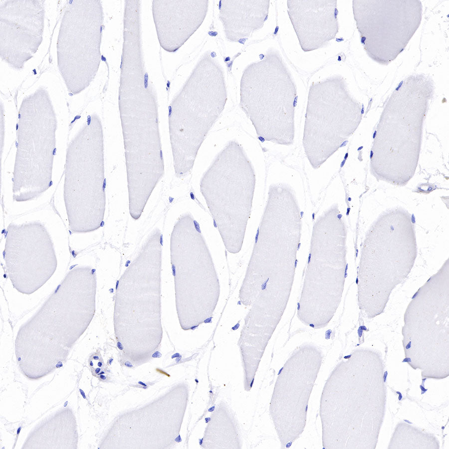 S-RMab®B7-H3/CD276 Recombinant Rabbit mAb (SDT-R158)