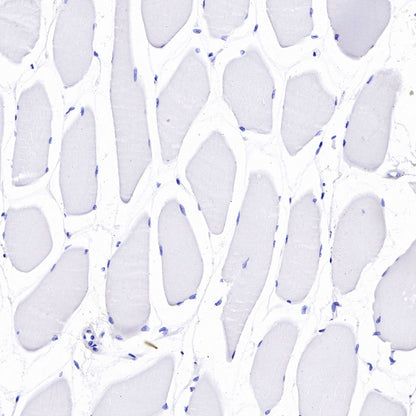 S-RMab®B7-H3/CD276 Recombinant Rabbit mAb (SDT-R158)