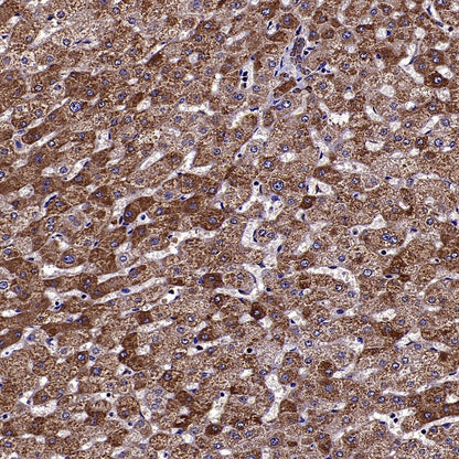 VDAC2 Rabbit Polyclonal Antibody