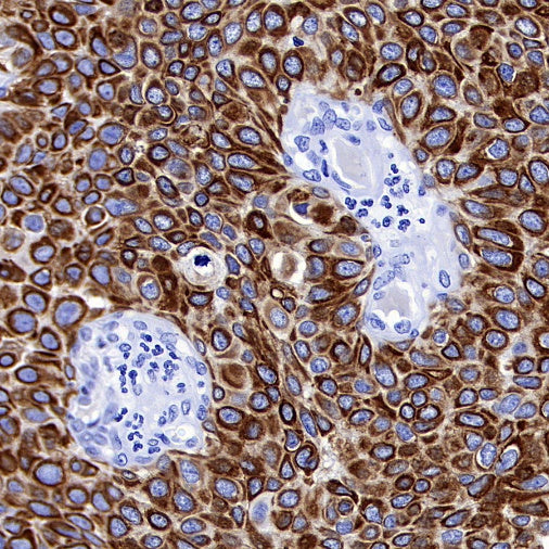 CK-13 Recombinant Rabbit mAb (SDT-R282)