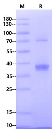 Biotinylated CD20 Flag&Avi Tag Full Length Protein, Human (Detergent)