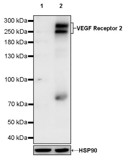 VEGF Receptor 2/FLK-1 Recombinant Rabbit mAb (SDT-1519-144)