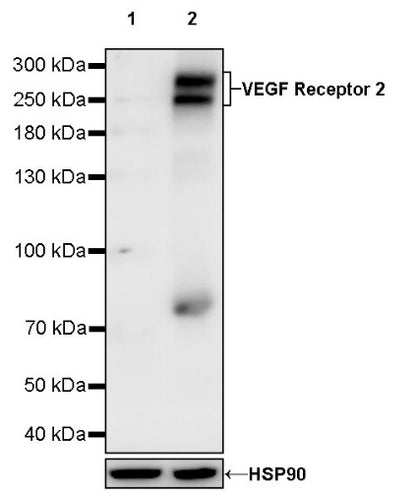 VEGF Receptor 2/FLK-1 Recombinant Rabbit mAb (SDT-1519-144)