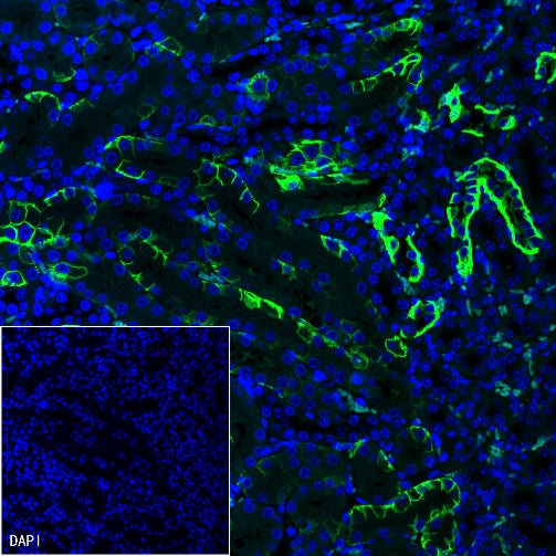 AQP4 Recombinant Rabbit mAb (S-1609-62)