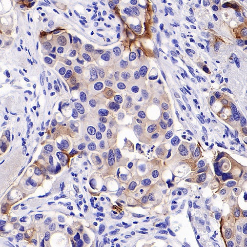 Integrin beta 6 Recombinant Rabbit mAb (SDT-1445-78)