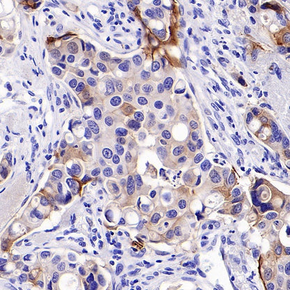 Integrin beta 6 Recombinant Rabbit mAb (SDT-1445-78)