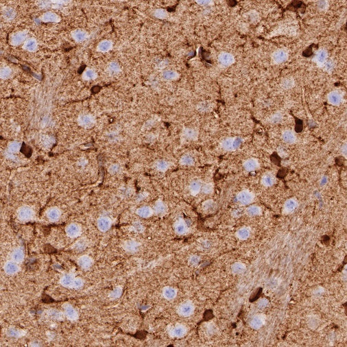 Glutamine Synthetase (GS) Recombinant Rabbit mAb (SDT-549-25)