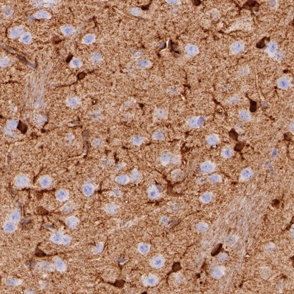 Glutamine Synthetase (GS) Recombinant Rabbit mAb (SDT-549-25)