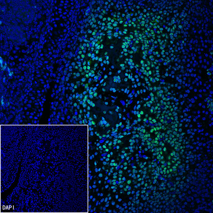Sp7/Osterix Recombinant Rabbit mAb (S-4225-14)