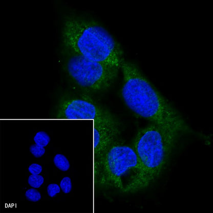 CTEN Recombinant Rabbit mAb (SDT-R175)