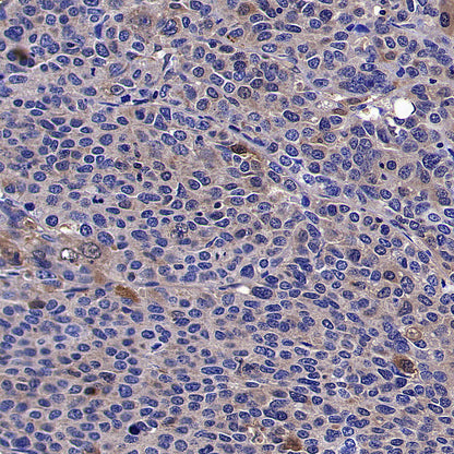 TXNRD1 Mouse mAb (S-M0053)