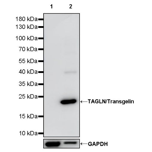 TAGLN/Transgelin Recombinant Rabbit mAb (S-1715-59)