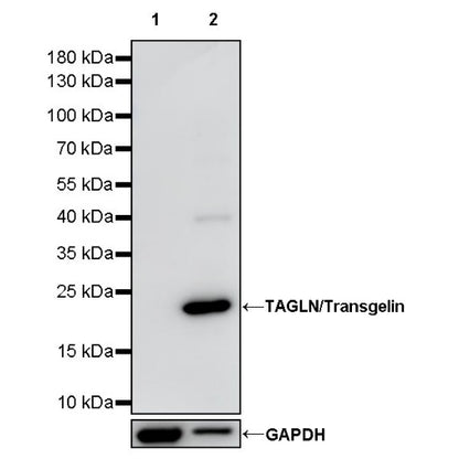 TAGLN/Transgelin Recombinant Rabbit mAb (S-1715-59)