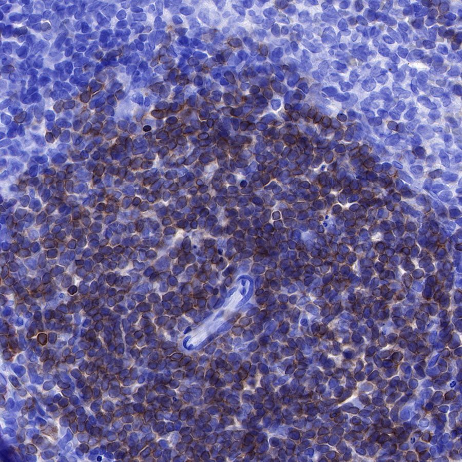 CD3 epsilon Recombinant Rabbit mAb (SDT-241-49)
