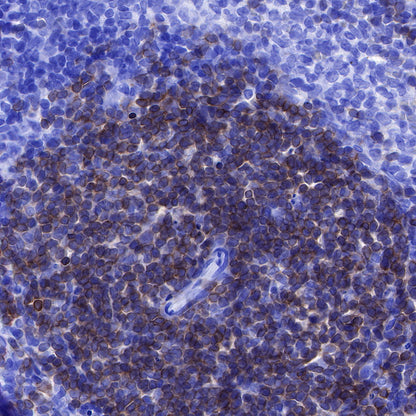 CD3 epsilon Recombinant Rabbit mAb (SDT-241-49)