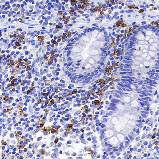 CD20 Recombinant Rabbit mAb (SDT-038-205)