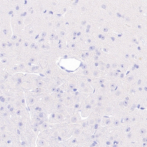 Rat Anti-Mouse CD45R/B220 Antibody (RA3-6B2)