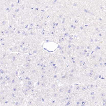 Rat Anti-Mouse CD45R/B220 Antibody (RA3-6B2)