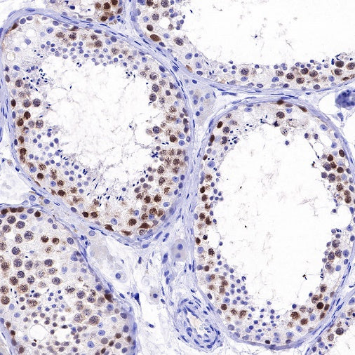 Rad51 Recombinant Rabbit mAb (S-R347)