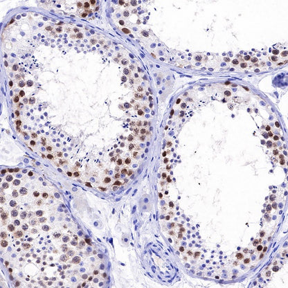 Rad51 Recombinant Rabbit mAb (S-R347)