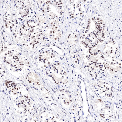 PSME1 Recombinant Rabbit mAb (S-732-14)