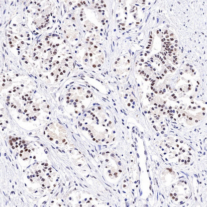 PSME1 Recombinant Rabbit mAb (S-732-14)
