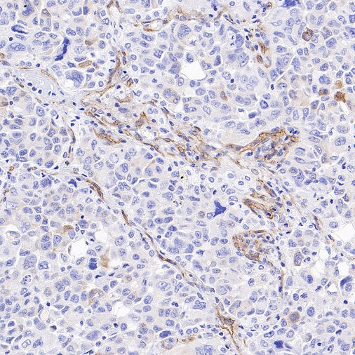 VEGF Receptor 2/FLK-1 Recombinant Rabbit mAb (SDT-1519-144)