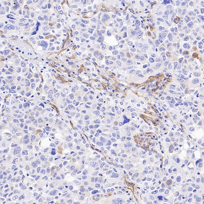VEGF Receptor 2/FLK-1 Recombinant Rabbit mAb (SDT-1519-144)