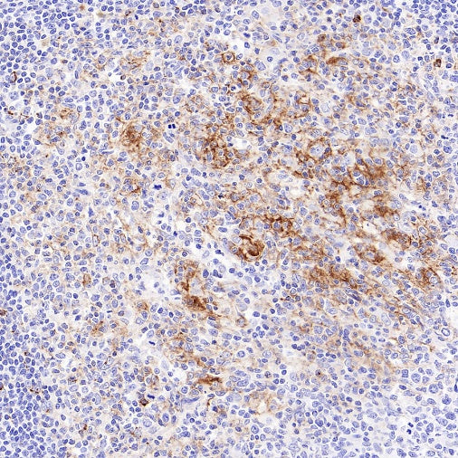 CXCL13 Recombinant Rabbit mAb (SDT-2703-132)