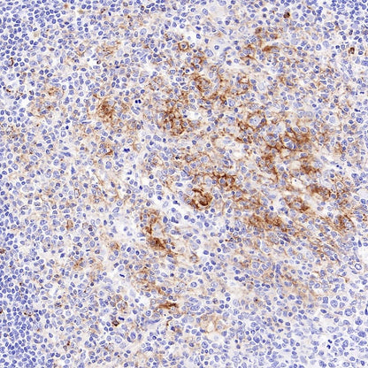 CXCL13 Recombinant Rabbit mAb (SDT-2703-132)