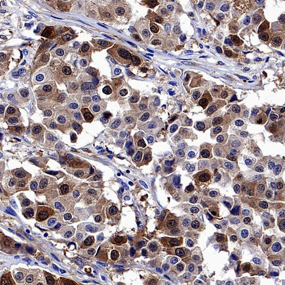 CDK1 Recombinant Rabbit mAb (S-1374-66)