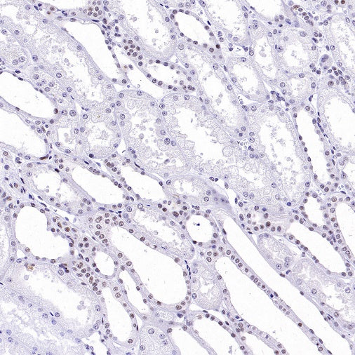 Symmetric Dimethyl Arginine (SDMA) Rabbit mAb (S-2129-14)