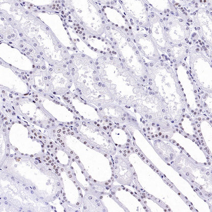 Symmetric Dimethyl Arginine (SDMA) Rabbit mAb (S-2129-14)