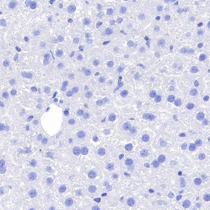 Myelin Basic Protein Recombinant Rabbit mAb (S-582-79)