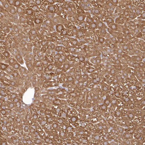 ALDH1A1 Rabbit Polyclonal Antibody