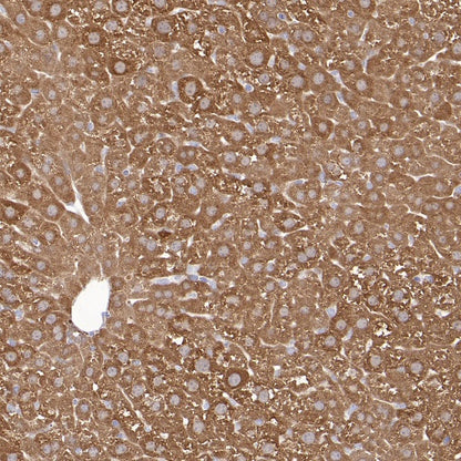 ALDH1A1 Rabbit Polyclonal Antibody