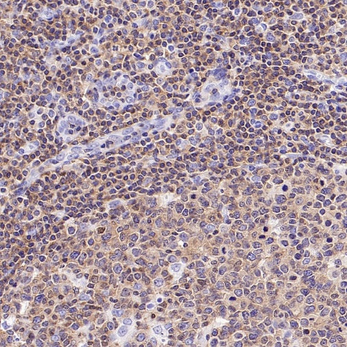 NFAT2 Recombinant Mouse mAb (S-4705)