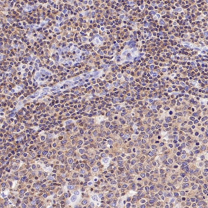 NFAT2 Recombinant Mouse mAb (S-4705)