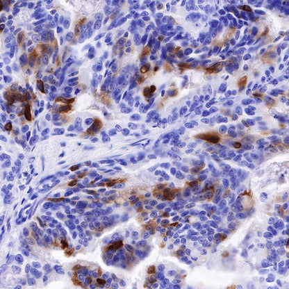 TFF1 Recombinant Rabbit mAb (S-481-16)