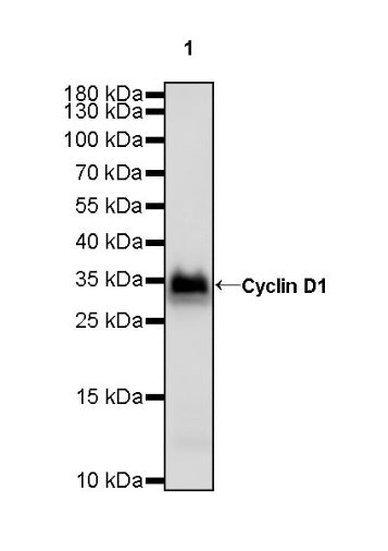 Cyclin D1 Recombinant Rabbit mAb (SDT-R423)
